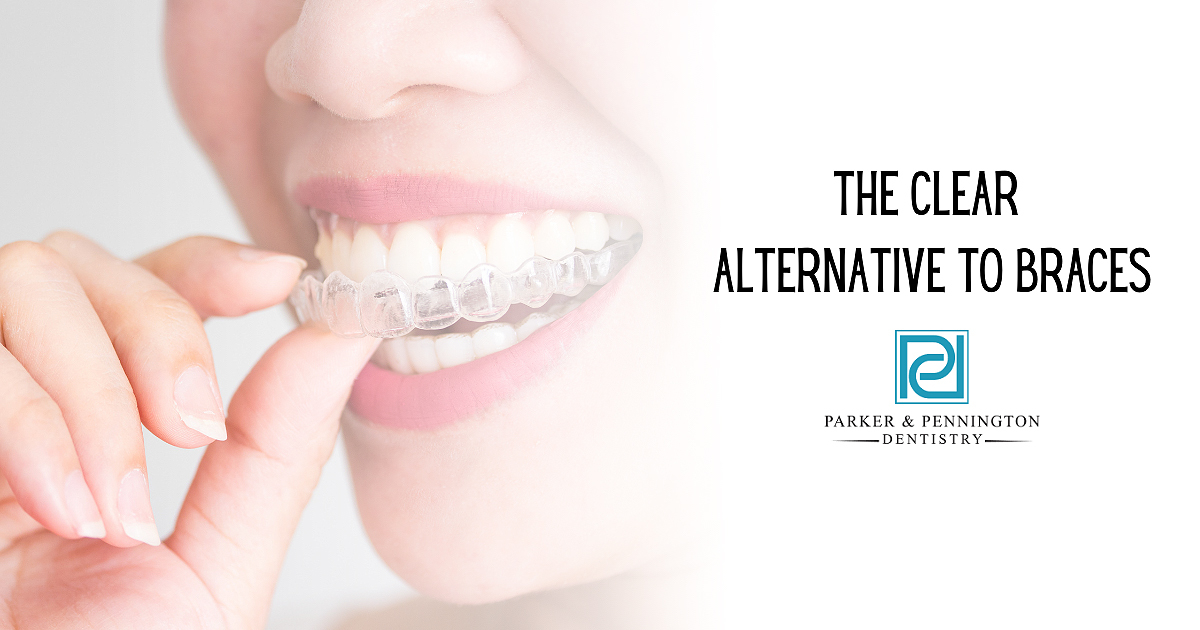 Parker_Blog_1200x630–