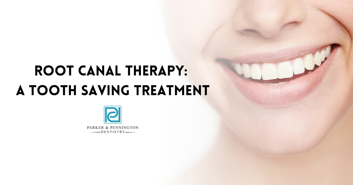 Root Canal Therapy: A Tooth Saving Treatment - Parker & Pennington ...